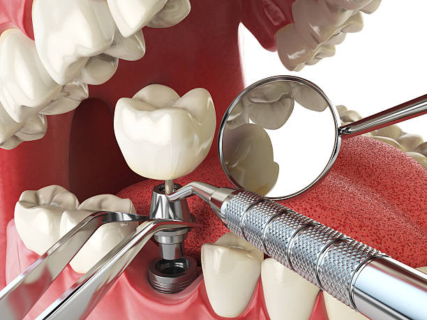 Best Emergency Treatment for Dental Infections or Abscesses in Goldsboro, NC